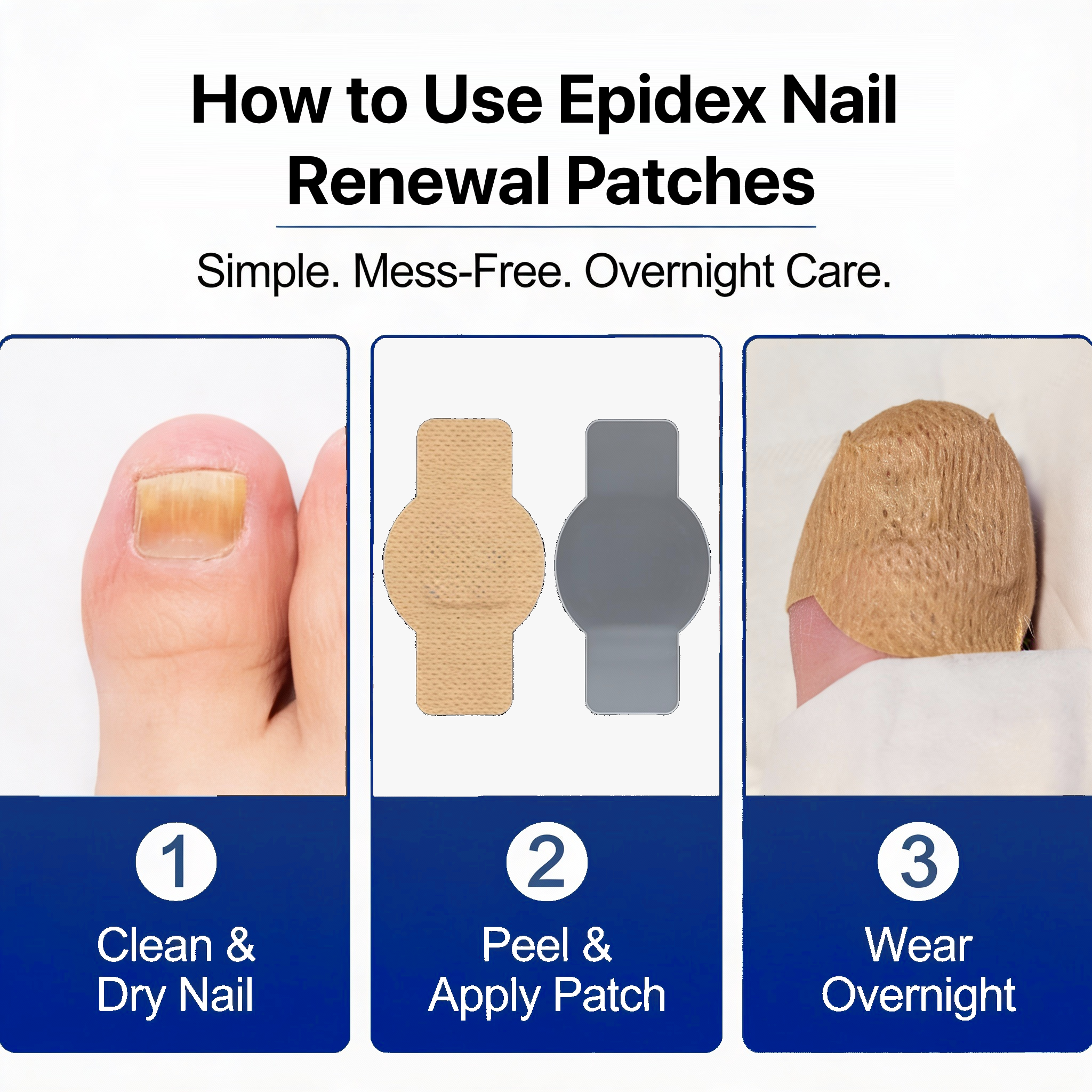 EPIDEX Fungal Nail Renewal Patches