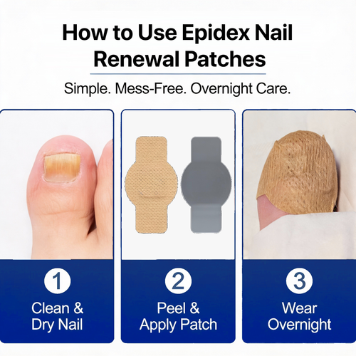 EPIDEX Fungal Nail Renewal Patches
